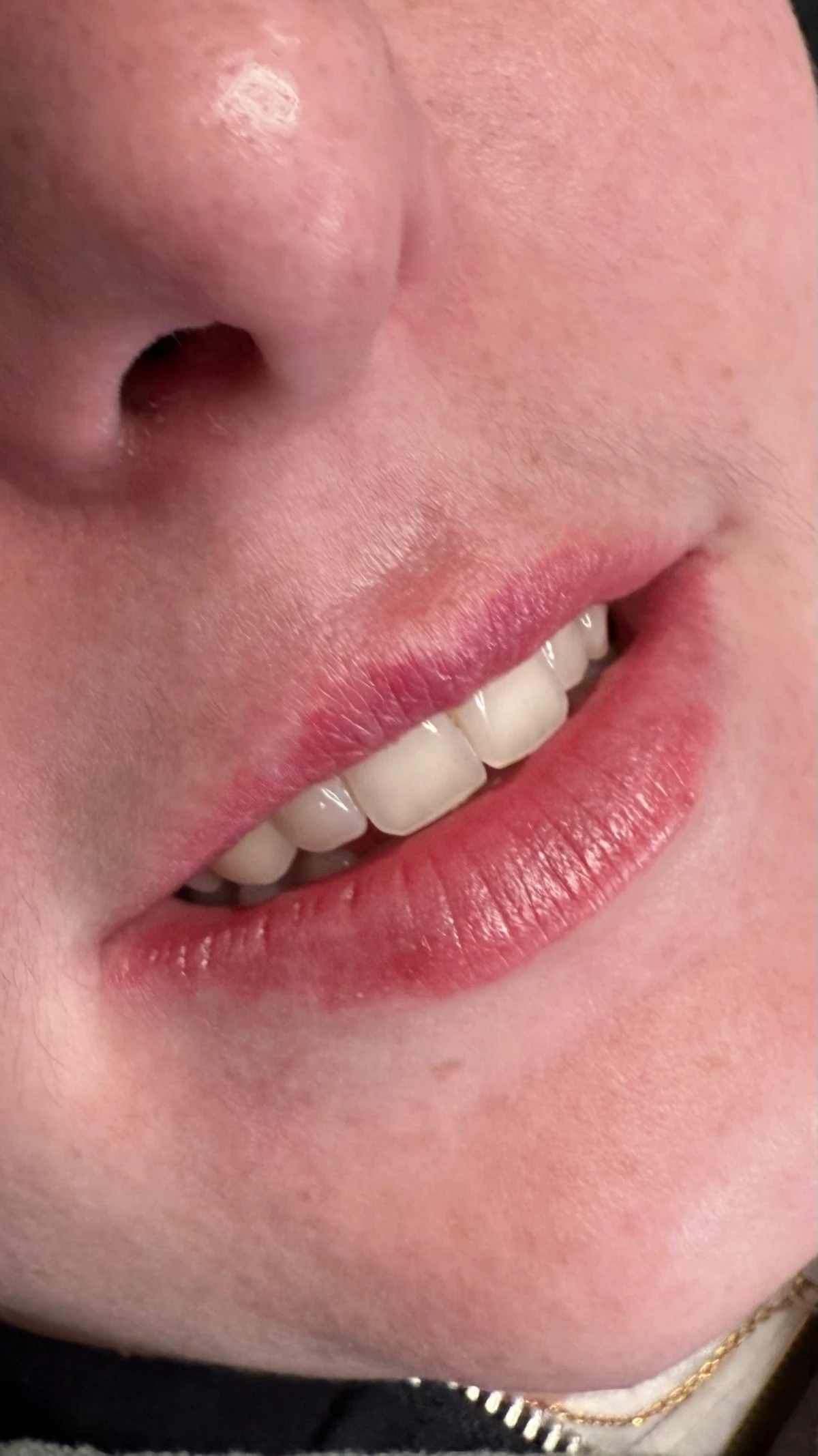 photo - Beauty Praktijk Alma Boerland