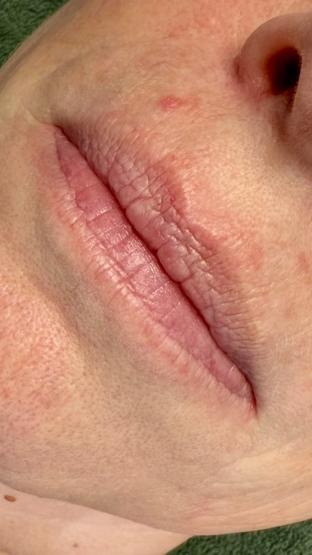 photo - Beauty Praktijk Alma Boerland