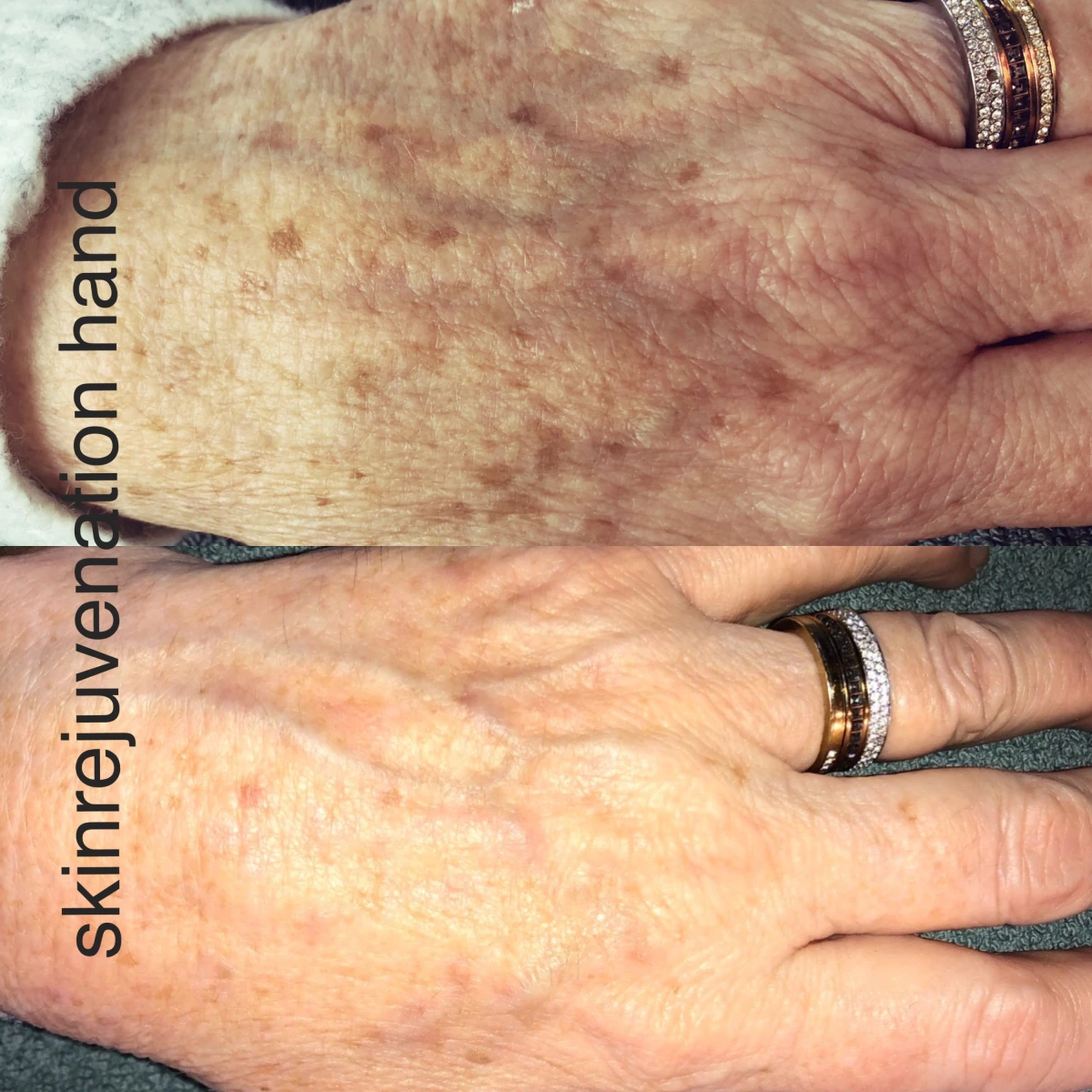 photo - Beauty Praktijk Alma Boerland