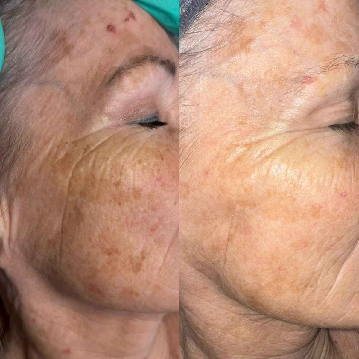 photo - Beauty Praktijk Alma Boerland