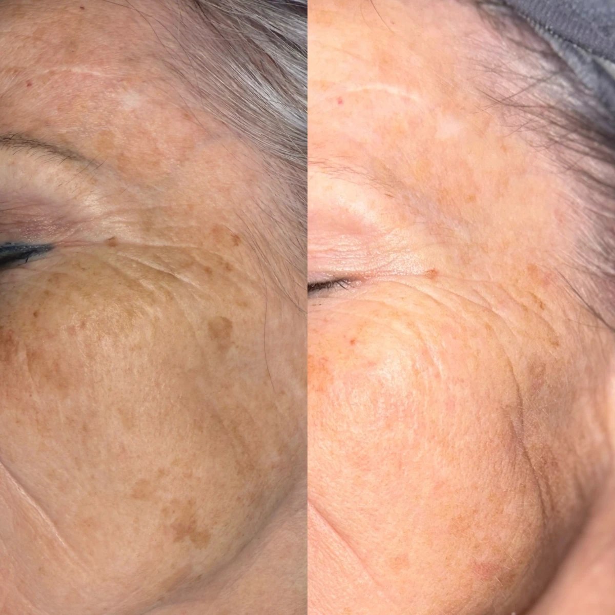 photo - Beauty Praktijk Alma Boerland