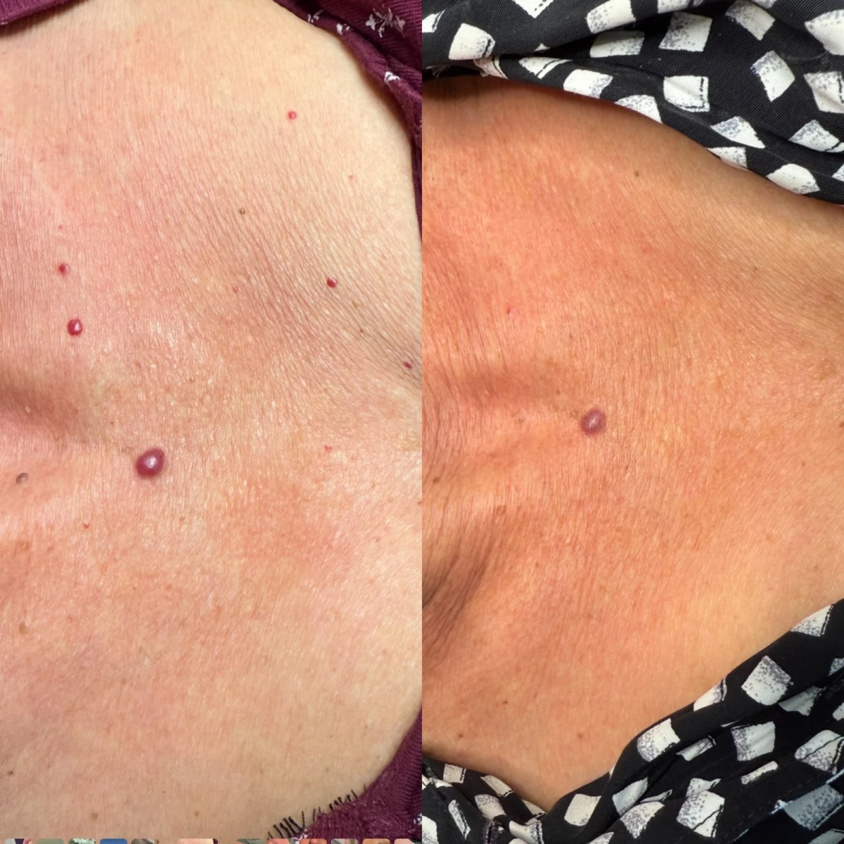 photo - Beauty Praktijk Alma Boerland