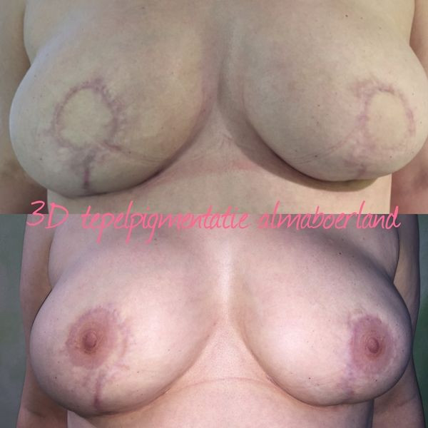 photo - Beauty Praktijk Alma Boerland