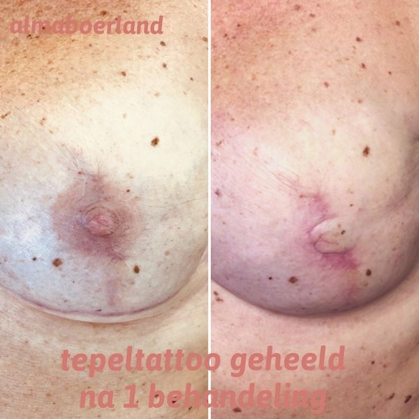 photo - Beauty Praktijk Alma Boerland