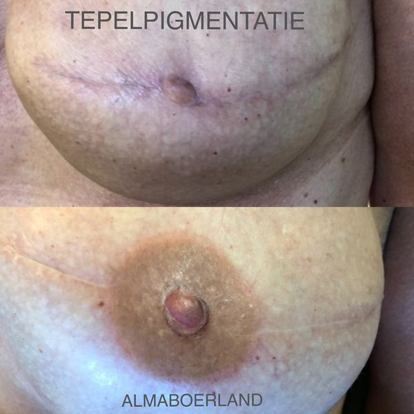 photo - Beauty Praktijk Alma Boerland