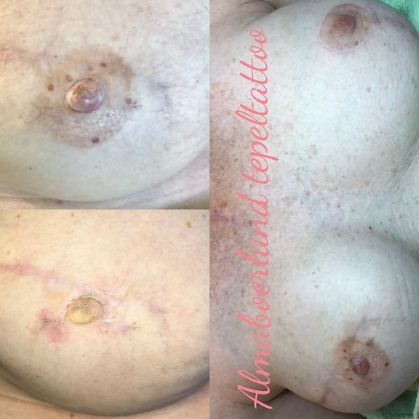 photo - Beauty Praktijk Alma Boerland