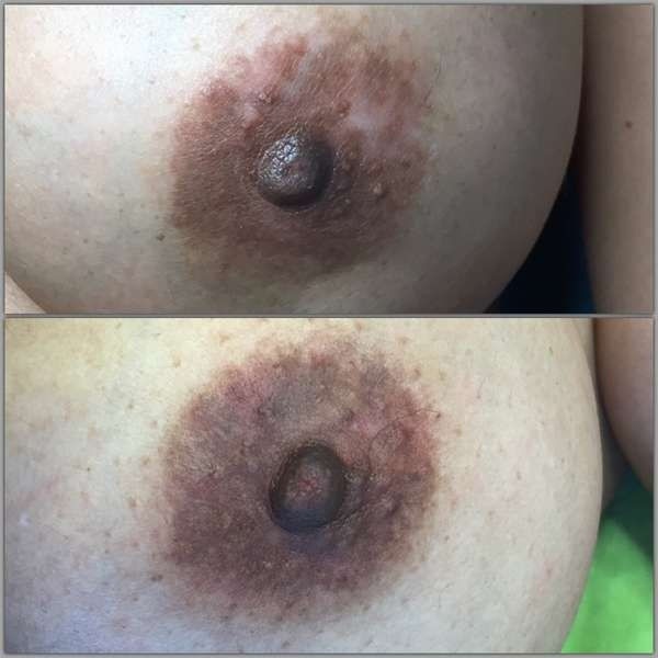 photo - Beauty Praktijk Alma Boerland