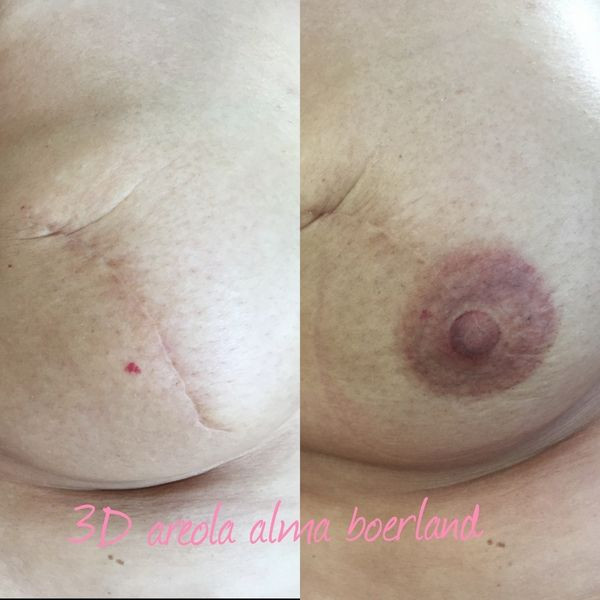 photo - Beauty Praktijk Alma Boerland