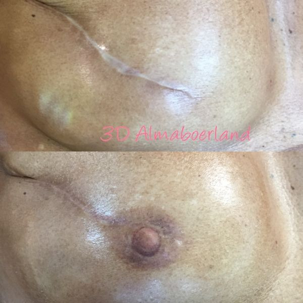 photo - Beauty Praktijk Alma Boerland