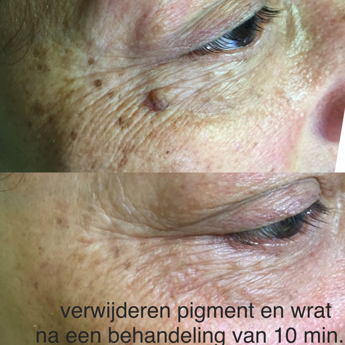 photo - Beauty Praktijk Alma Boerland