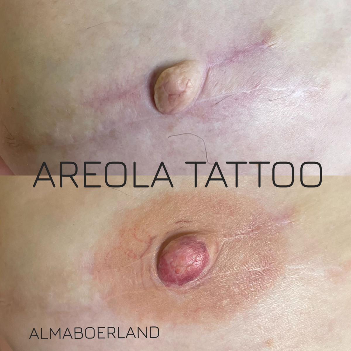 photo - Beauty Praktijk Alma Boerland