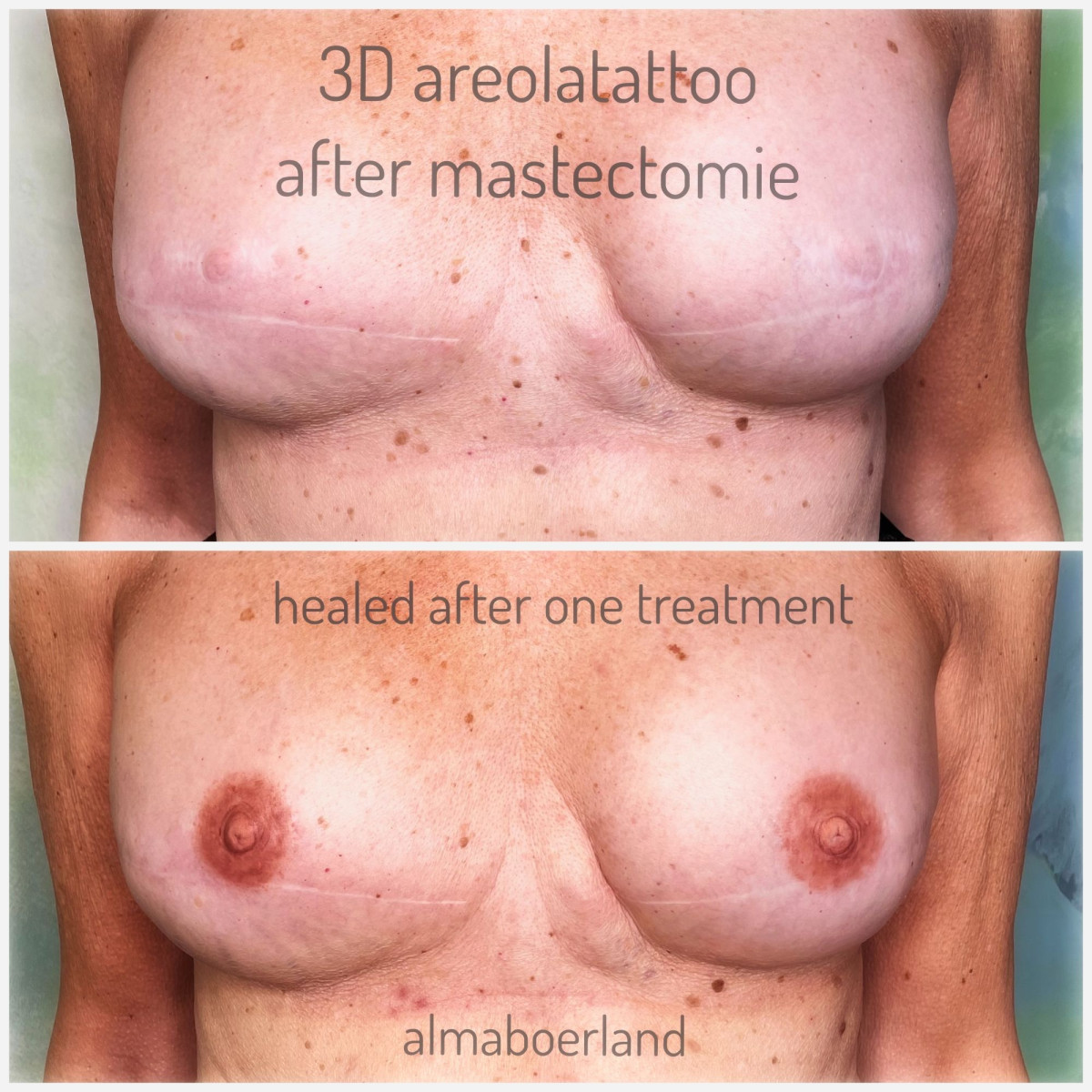 photo - Beauty Praktijk Alma Boerland