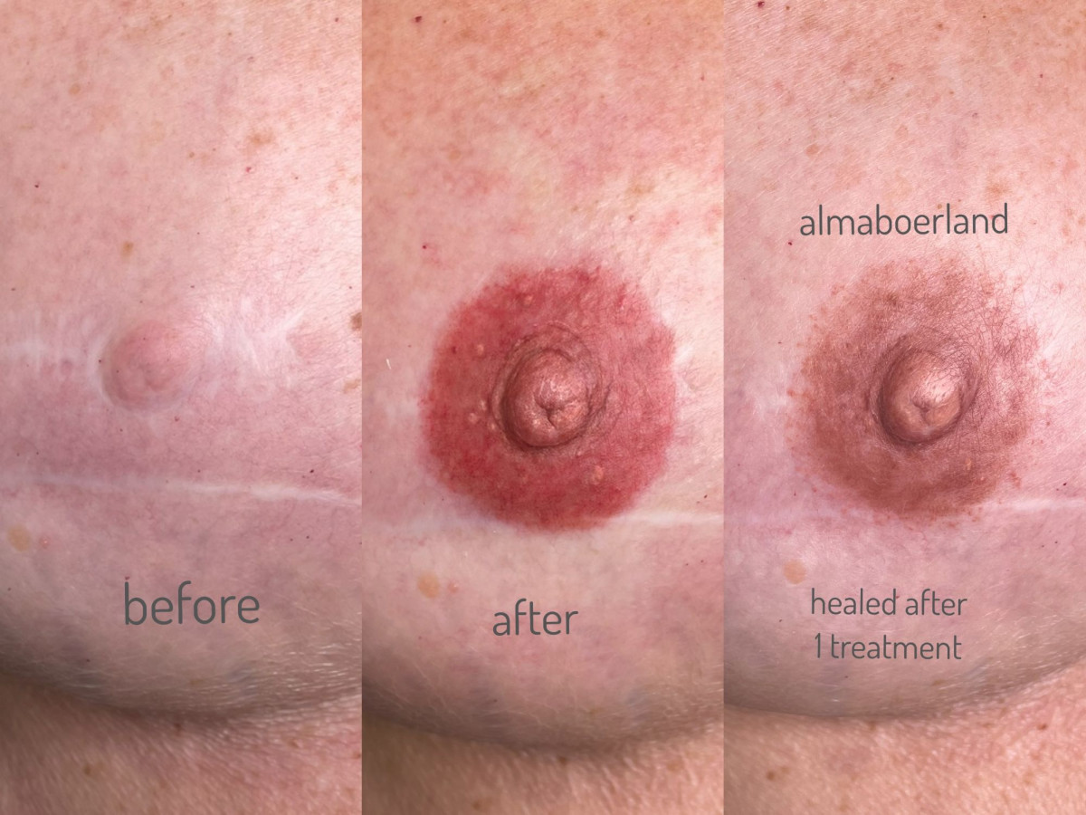 photo - Beauty Praktijk Alma Boerland