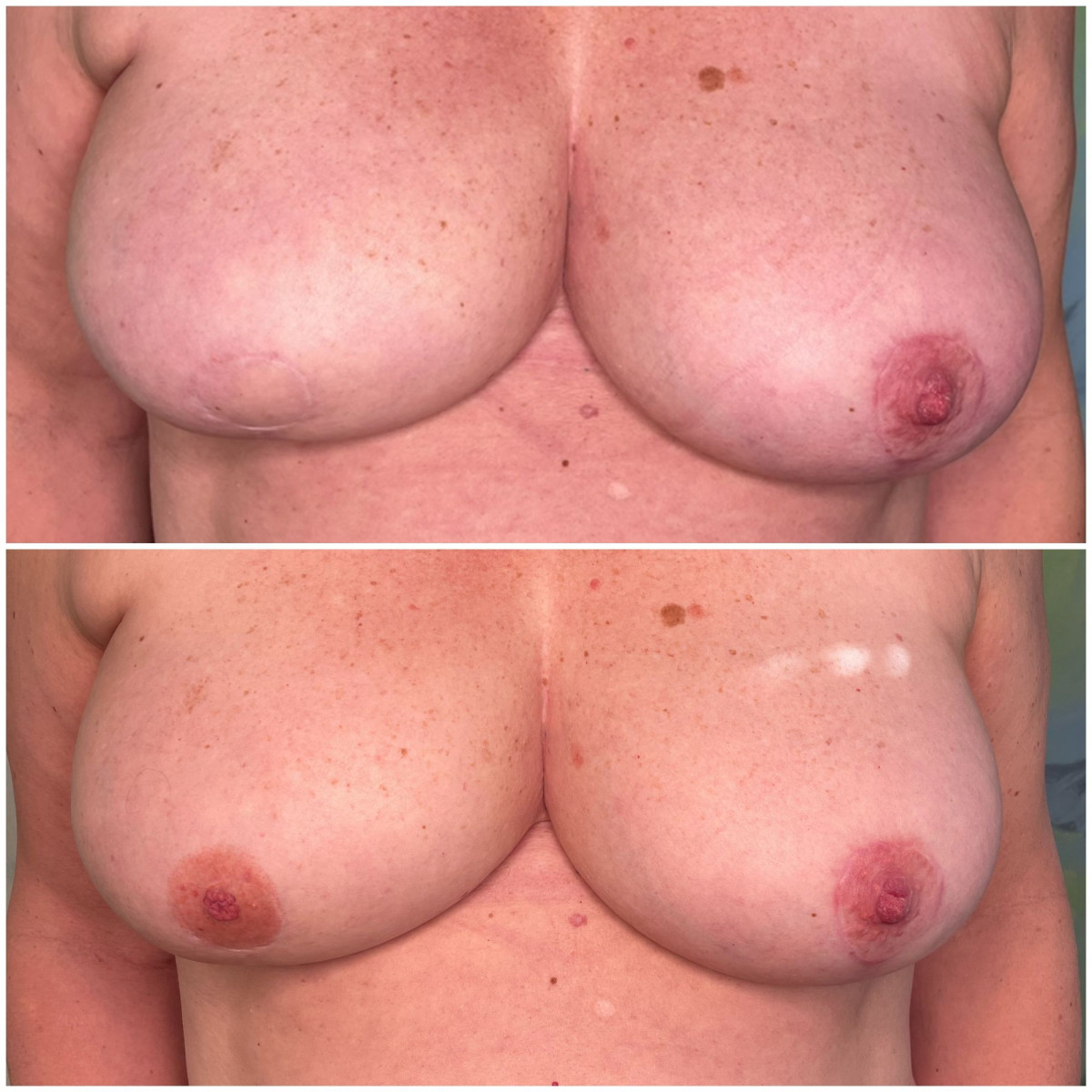 photo - Beauty Praktijk Alma Boerland