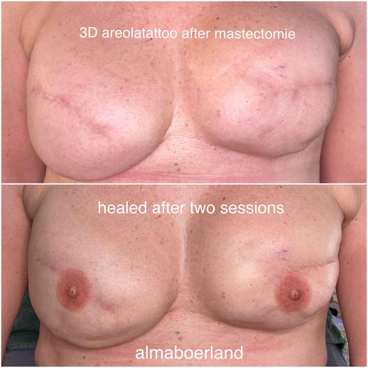 photo - Beauty Praktijk Alma Boerland