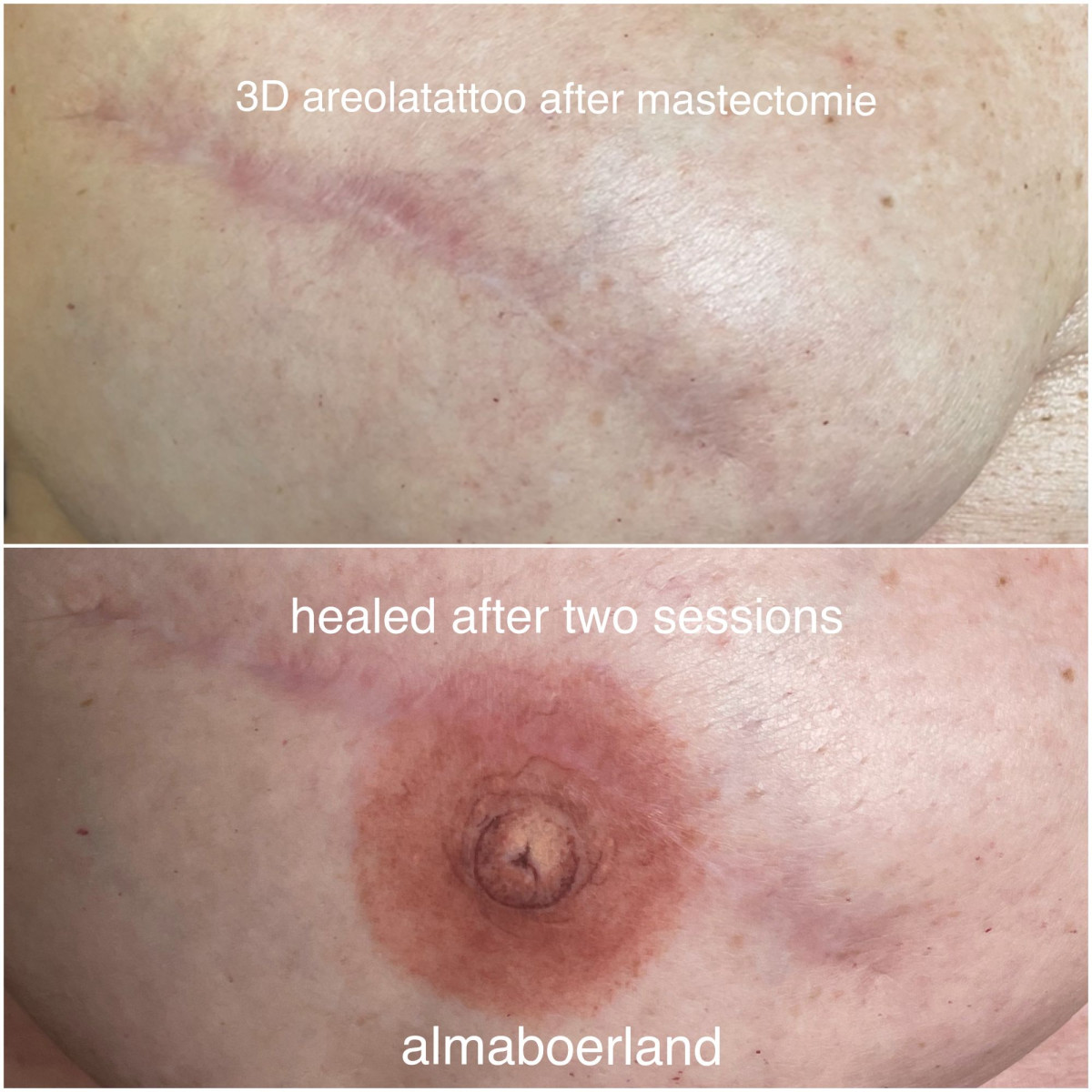 photo - Beauty Praktijk Alma Boerland