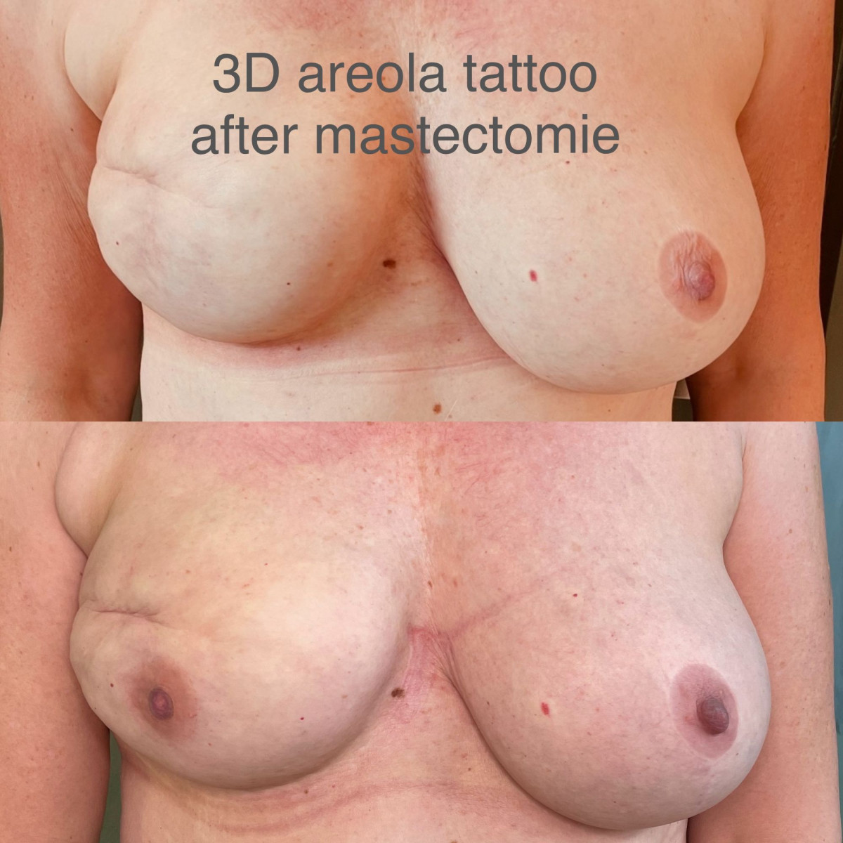 photo - Beauty Praktijk Alma Boerland