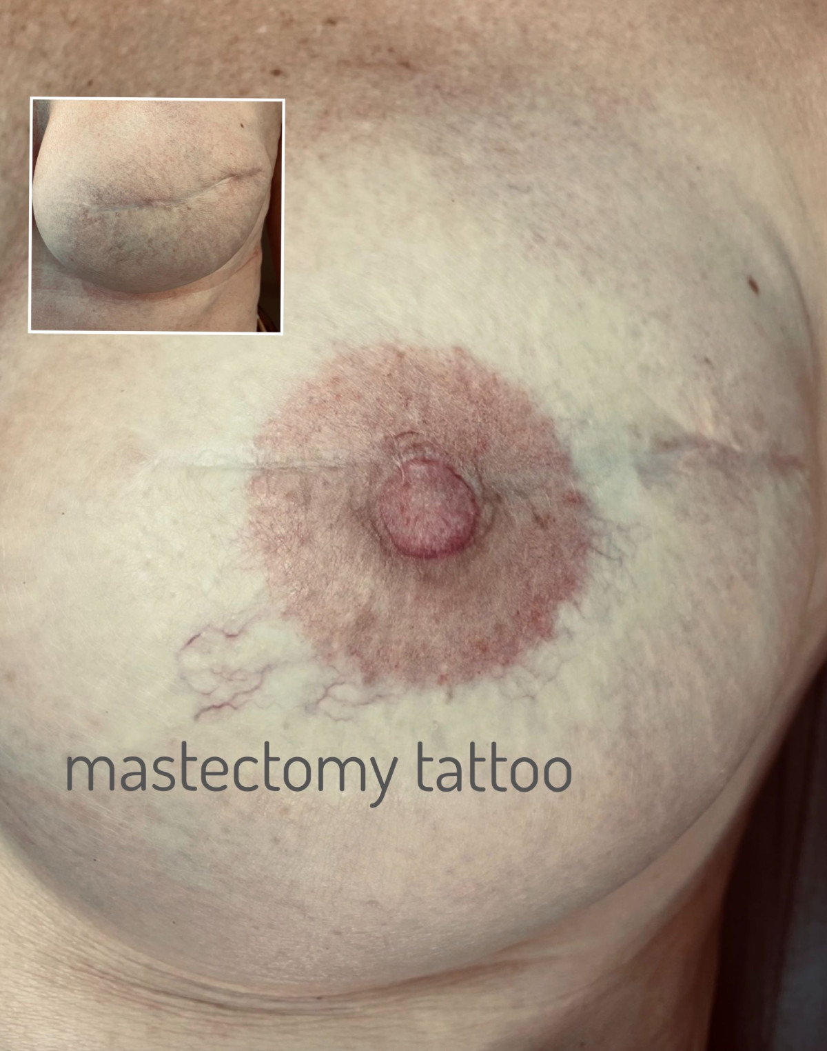 photo - Beauty Praktijk Alma Boerland