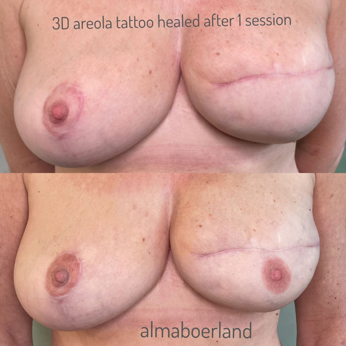 photo - Beauty Praktijk Alma Boerland