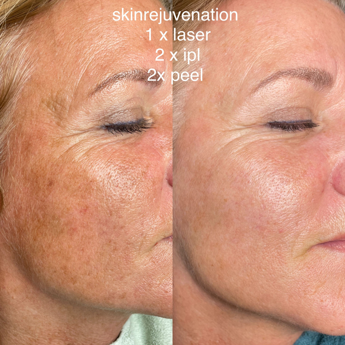 photo - Beauty Praktijk Alma Boerland