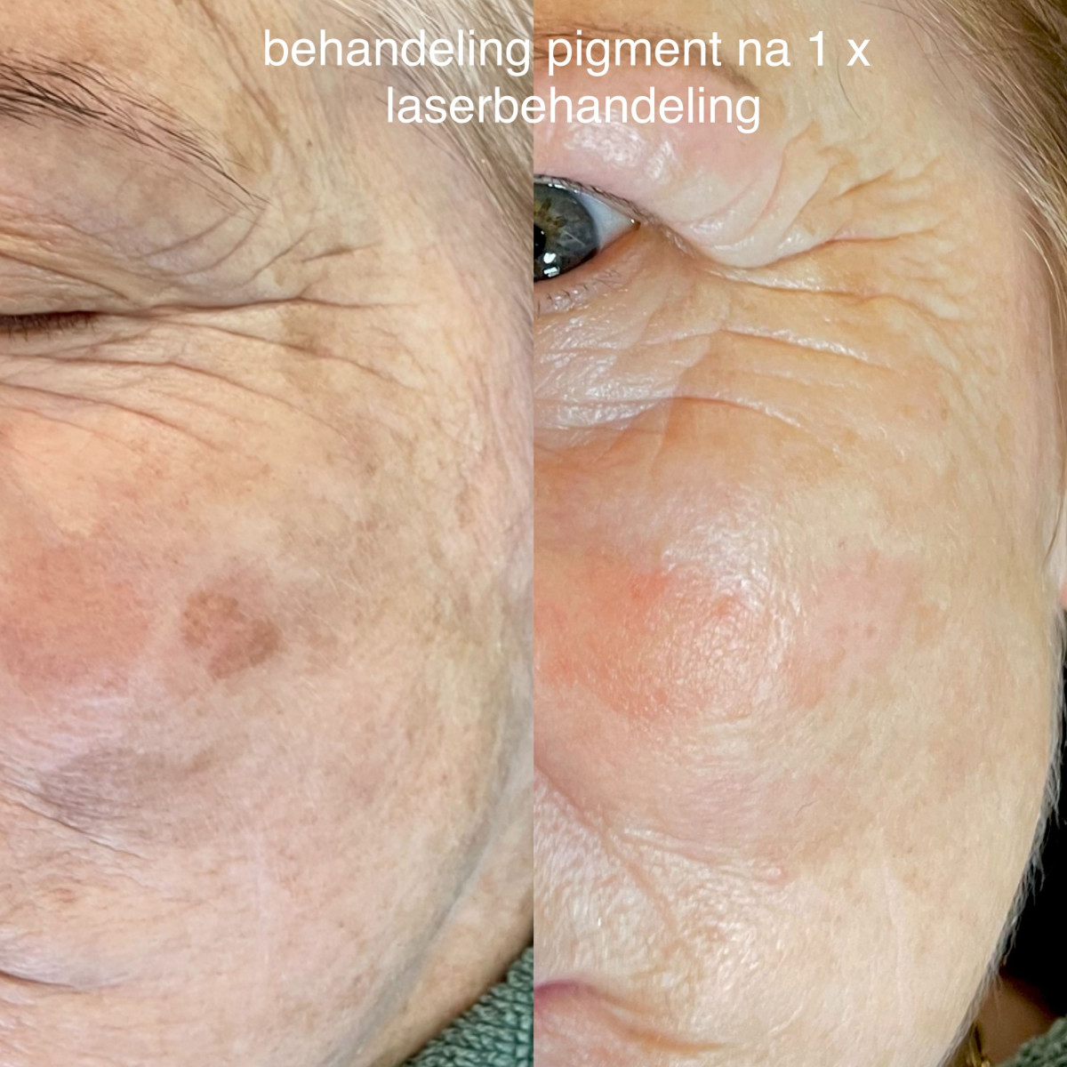 photo - Beauty Praktijk Alma Boerland