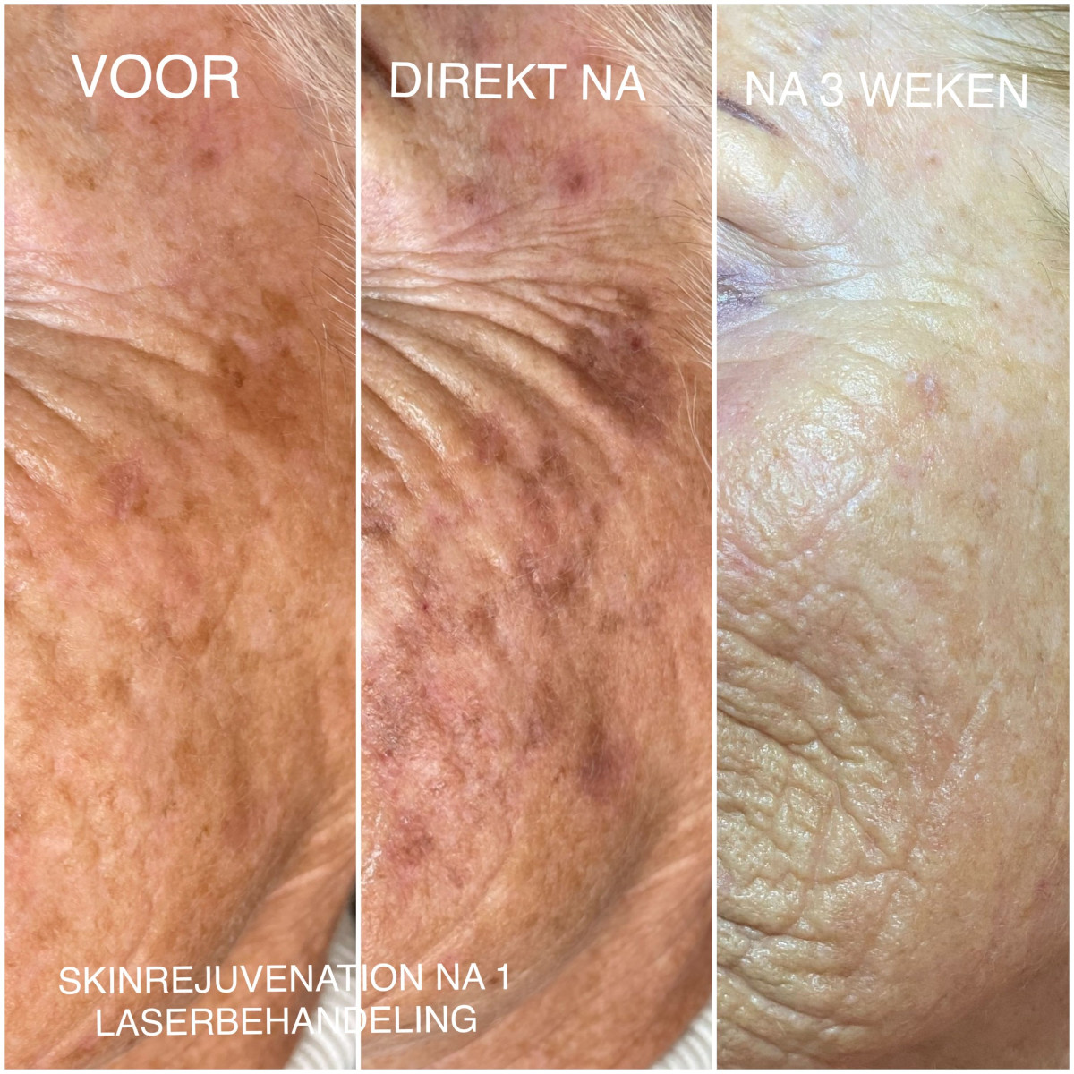 photo - Beauty Praktijk Alma Boerland