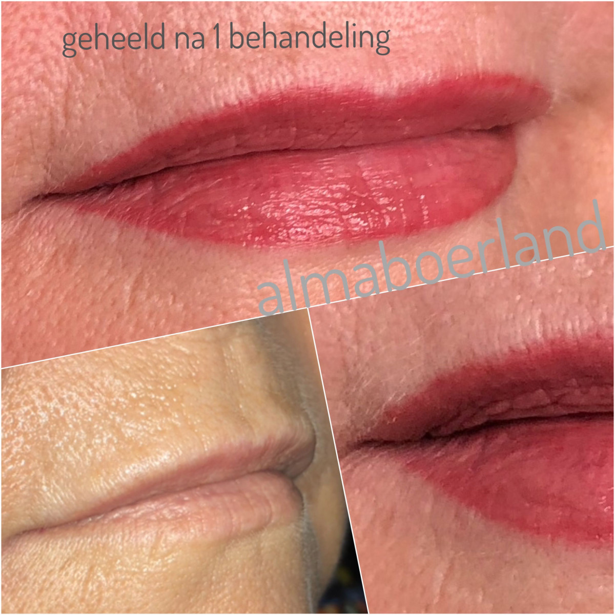 photo - Beauty Praktijk Alma Boerland