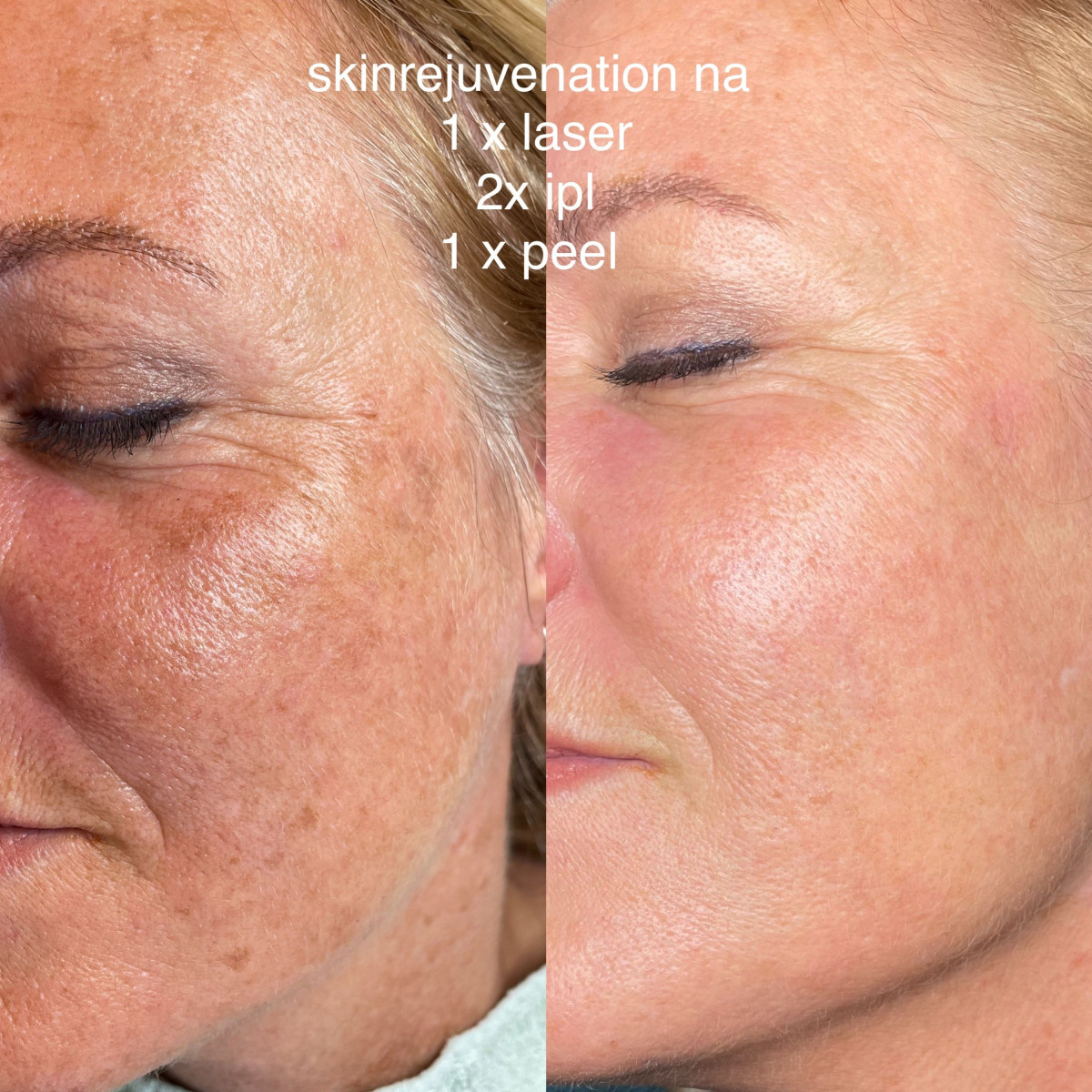 photo - Beauty Praktijk Alma Boerland