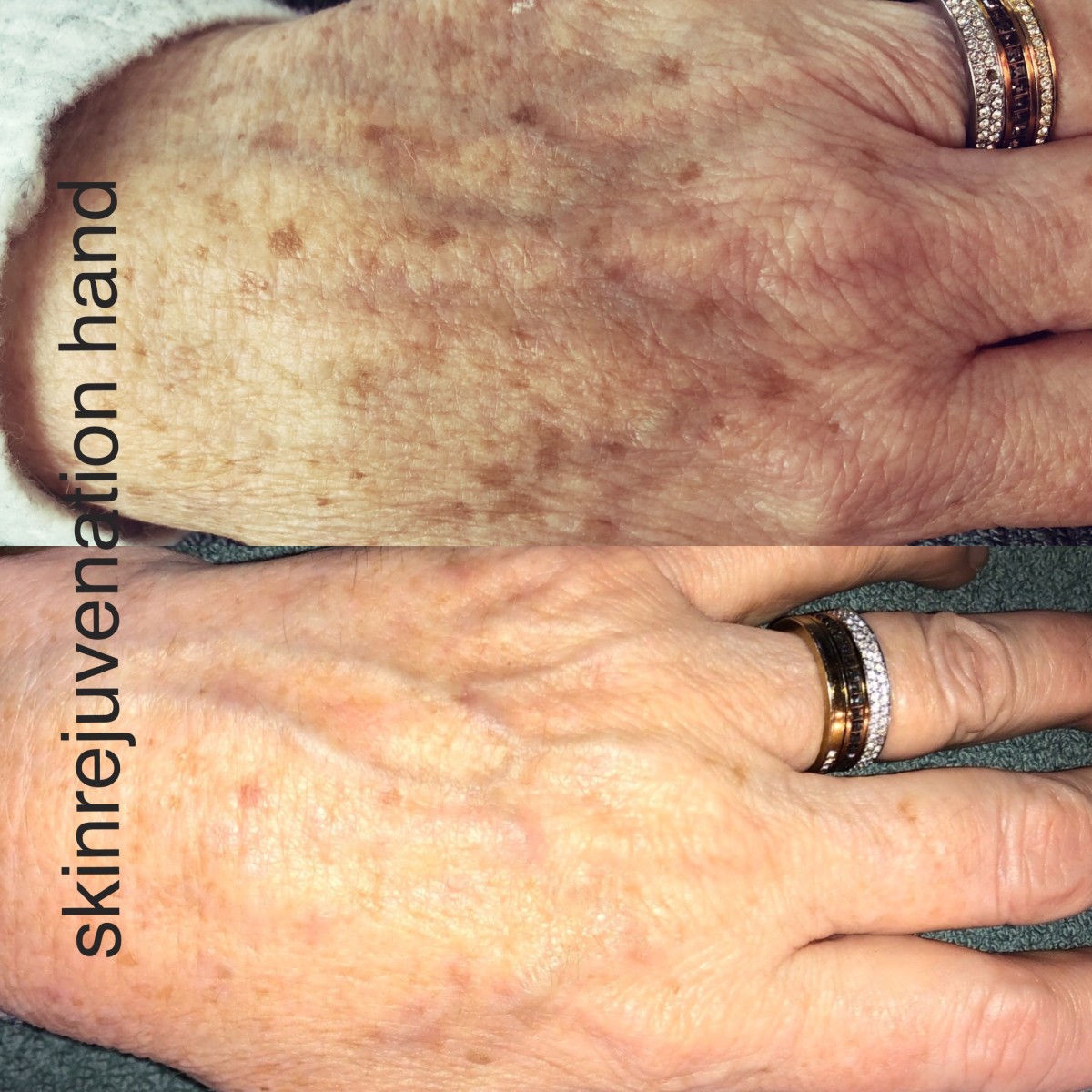 photo - Beauty Praktijk Alma Boerland